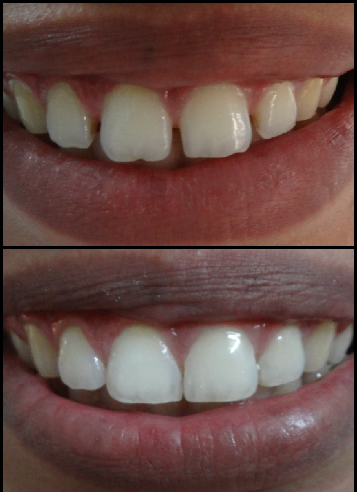 smile-story